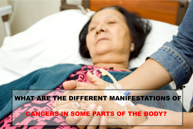WHAT ARE THE DIFFERENT MANIFESTATIONS OF CANCERS IN SOME PARTS OF THE BODY?